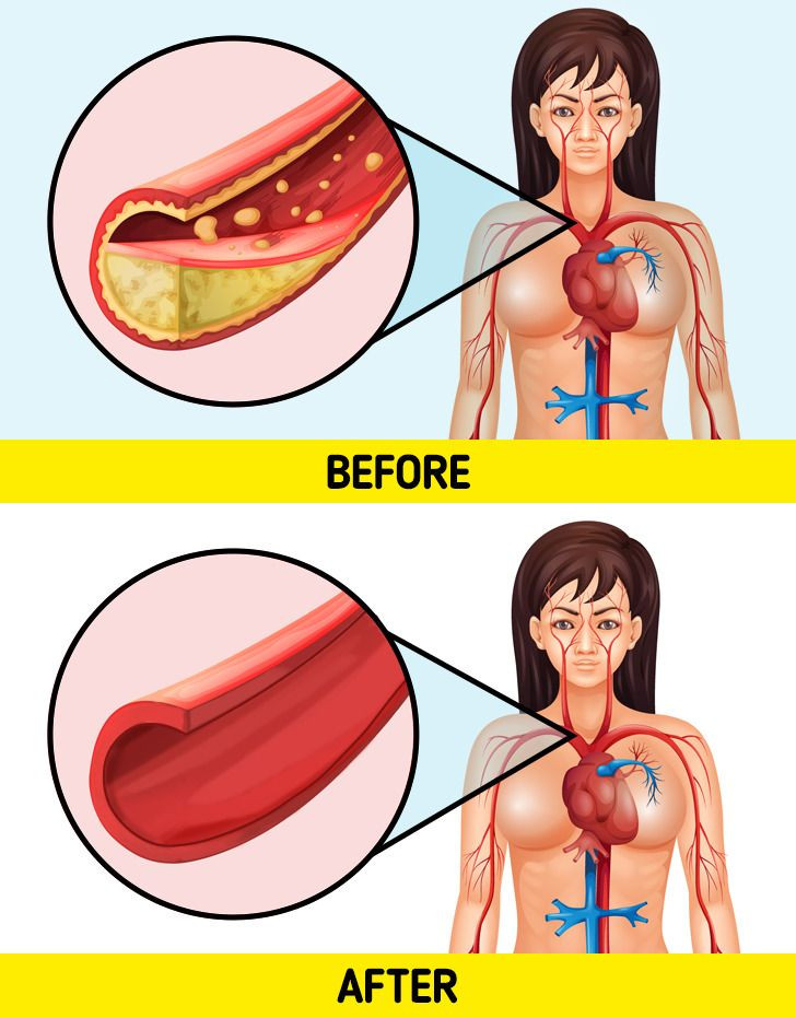 Điều gì sẽ xảy ra với cơ thể nếu bạn uống trà đen mỗi ngày - Hình 2 Dieu gi se xay ra voi co the neu ban uong tra den moi ngay-Hinh-2