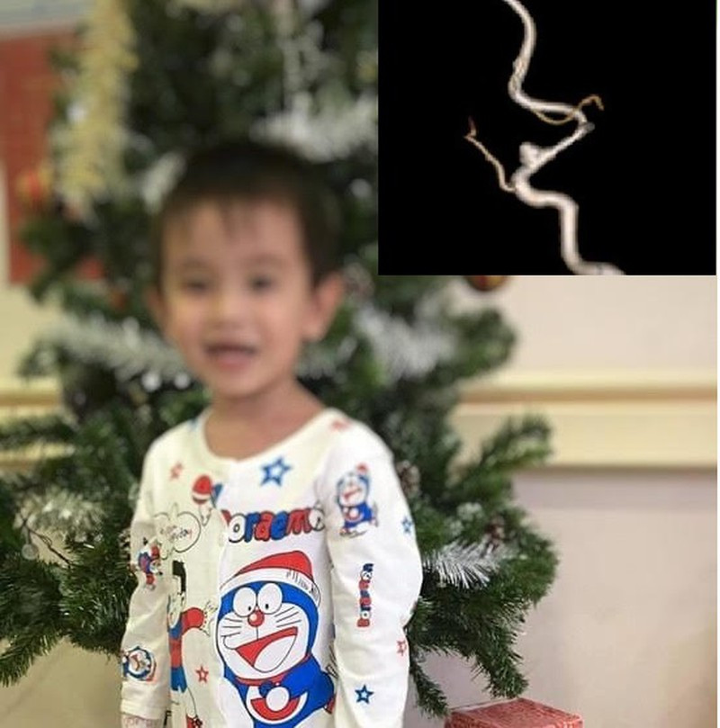 Be trai 3 tuoi bi dot quy: Cach nao phat hien som?