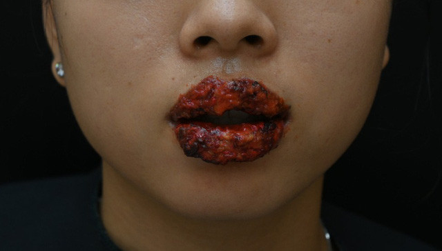 TMV phun moi be gai 5 tuoi: Tre doi mat nguy co gi?-Hinh-2