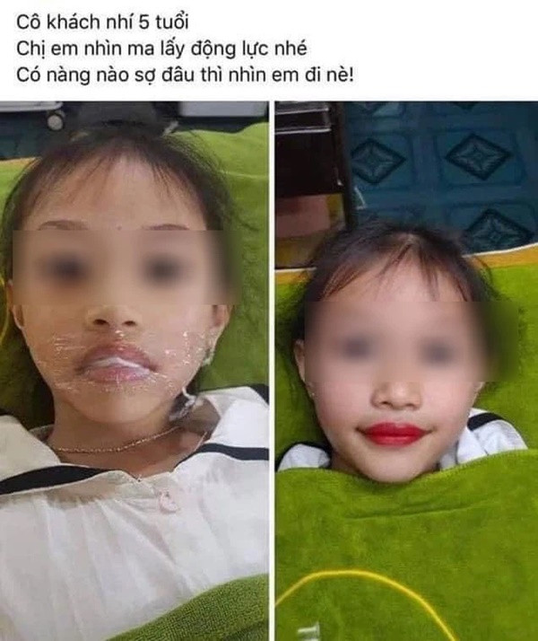 TMV phun moi be gai 5 tuoi: Tre doi mat nguy co gi?
