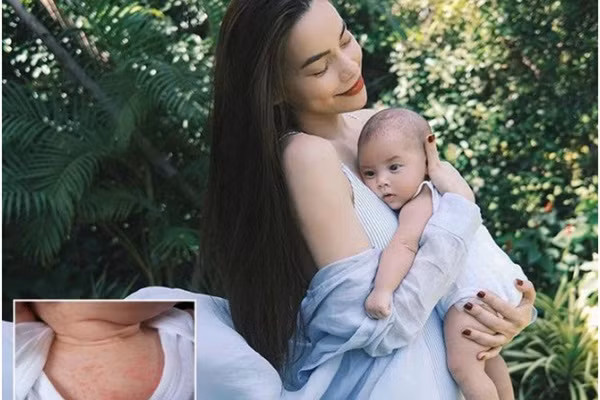 Con gai Ha Ho man do khap nguoi: Nguyen nhan, xu ly the nao?-Hinh-2