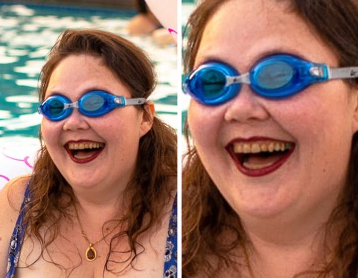 Bơi lội thường xuyên: Điểm đến yêu thích trong mùa hè của nhiều người là hồ bơi. Tuy nhiên, nếu bơi nhiều hơn 6 giờ mỗi tuần, rất có thể bạn sẽ nhận thấy hàm răng tích tụ màu nâu do các loại hoá chất trong nước hồ bơi gây ra vết ố trên răng.