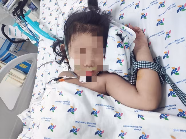 Soc sot xuat huyet tre nguy kich: Khi nao can di vien?