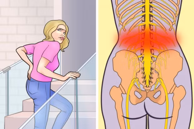 6. Thường xuyên đi cầu thang bộ: Dù đi cầu thang bộ được coi là thói quen lành mạnh nhưng đây không phải phương pháp tập luyện để duy trì vóc dáng tốt nhất nếu bạn đang bị đau thắt lưng. Người bị đau đầu gối hoặc đau lưng nên hỏi ý kiến bác sĩ trước khi tập thể dục bằng cách leo cầu thang bộ.