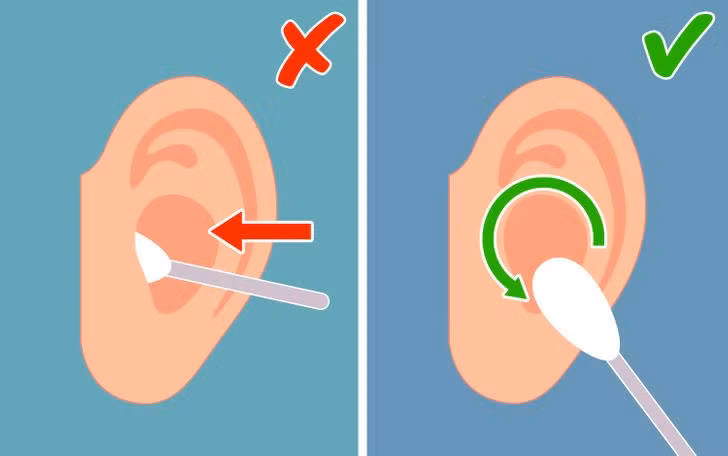 3. Ráy tai có chức năng như một chất làm sạch: Nhiều người trong chúng ta luôn nghĩ rằng cần làm sạch ráy tai hàng ngày vì lý do vệ sinh. Tuy nhiên, khoa học chứng minh rằng mọi thứ hoàn toàn ngược lại. Ráy tai tự nó làm sạch ống tai của chúng ta và bảo vệ nó khỏi nhiễm trùng. Việc loại bỏ ráy tai gây ra nhiều tác hại hơn là có lợi cho chúng ta, vì vậy tốt hơn là chỉ nên làm sạch nó từ bề mặt của tai.