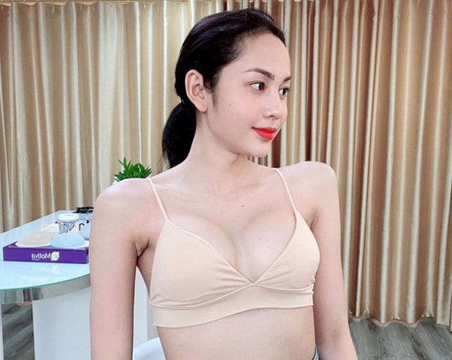 Câu chuyện về hành trình phẫu thuật chuyển giới của Lương Mỹ Kỳ từng được dân mạng chia sẻ rộng rãi.