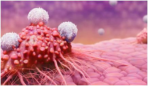 Một điều đáng báo động nhất chính là chế độ ăn với lượng muối cao. Việc ăn quá mặn hoặc các thực phẩm nhiều muối đã làm tổn thưởng niêm mạc dạ dày gây viêm niêm mạc, một triệu chứng của tiền ung thư dạ dày.