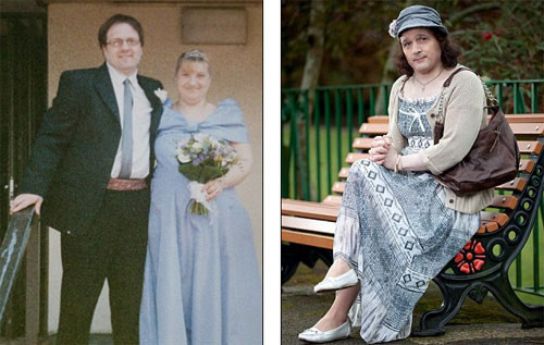 Hy huu truong hop mang co quan sinh san sai gioi tinh-Hinh-2