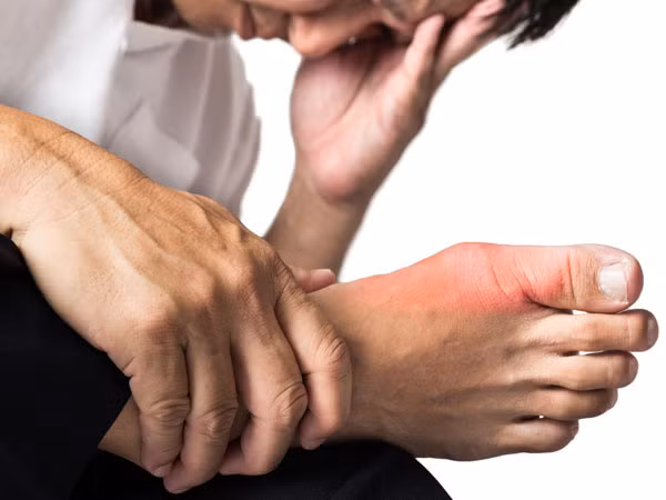 Sưng chân. Trong trường hợp chân bị đau và sưng do tai nạn, nhưng nếu kèm theo cảm giác khó chịu và tình trạng sưng không cải thiện hoặc cải thiện xong lại tái phát, cục máu đông có thể là nguyên nhân gây ra điều này.