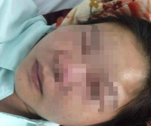 Nhiem trung, suyt chet vi nan mun o mui