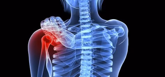 Đau xương: Một trong những triệu chứng chính của ung thư máu chính là đau xương. Các cơn đau có thể xuất hiện tùy theo mức độ của bệnh và thường xuất hiện ở khớp xương chân, đầu gối, cánh tay, lưng… Nguồn gốc của những cơn đau này là từ tủy xương – nơi sản xuất ra các tế bào máu.