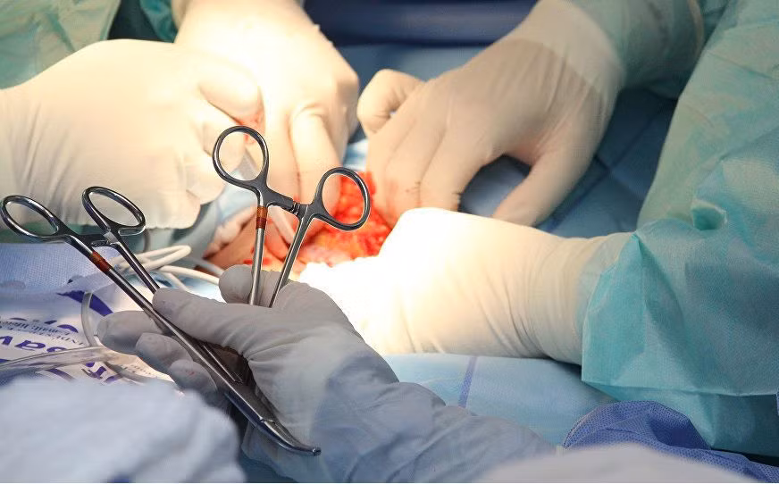  Xảy ra xích mích, người tình dùng dao cắt "của quý": Ngày 17/5/2018, do xảy ra xích mích tình cảm nên bị người tình lấy con dao ở bếp vào cắt “của quý” anh N.V.N (57 tuổi, trú tại Đồng Tháp) khi đang tắm, ngày 15/5/2018, anh N. đã đến cấp cứu trong tình trạng vết thương vùng bộ phận sinh dục lồi tinh hoàn, “của quý” bị cắt đứt sát gốc, đứt mạch máu, thể hang, chỉ còn dính phần niệu đạo... Ngay lập tức bệnh nhân được đưa vào phòng mổ nối “của quý”, 2 ngày sau phẫu thuật, “của quý” của anh đã được tưới máu tốt và phục hồi.