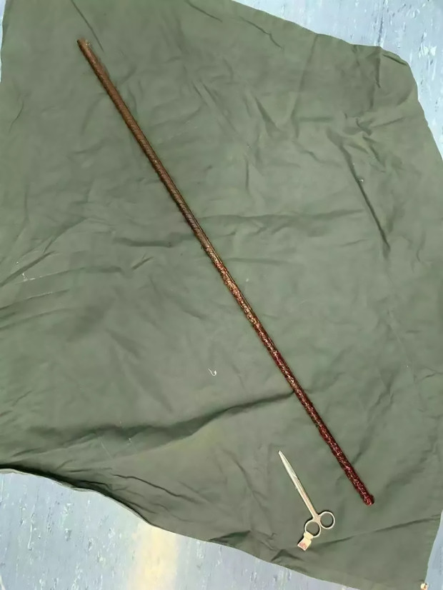 Bi thanh sat xoan dam xuyen nguoi, thanh nien thoat chet than ky-Hinh-3