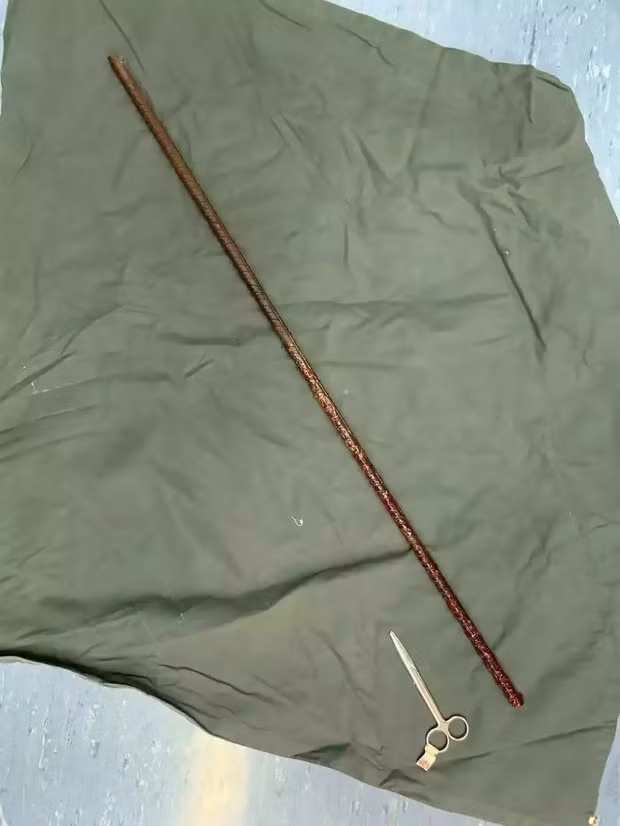 Bị thanh sắt xoắn đâm xuyên người, thanh niên thoát chết thần kỳ - Hình 3 Bi thanh sat xoan dam xuyen nguoi, thanh nien thoat chet than ky-Hinh-3