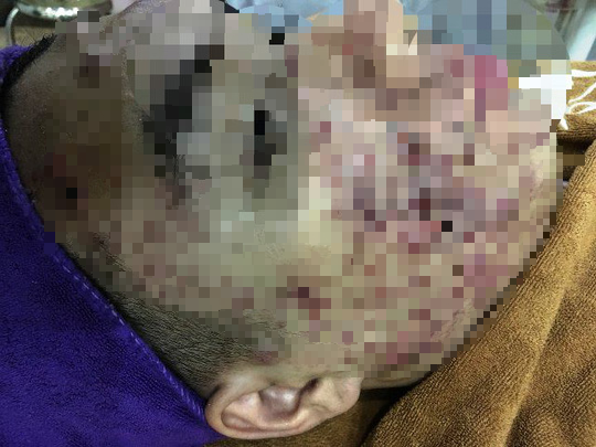 Bac si phat hoang voi khuon mat bi 