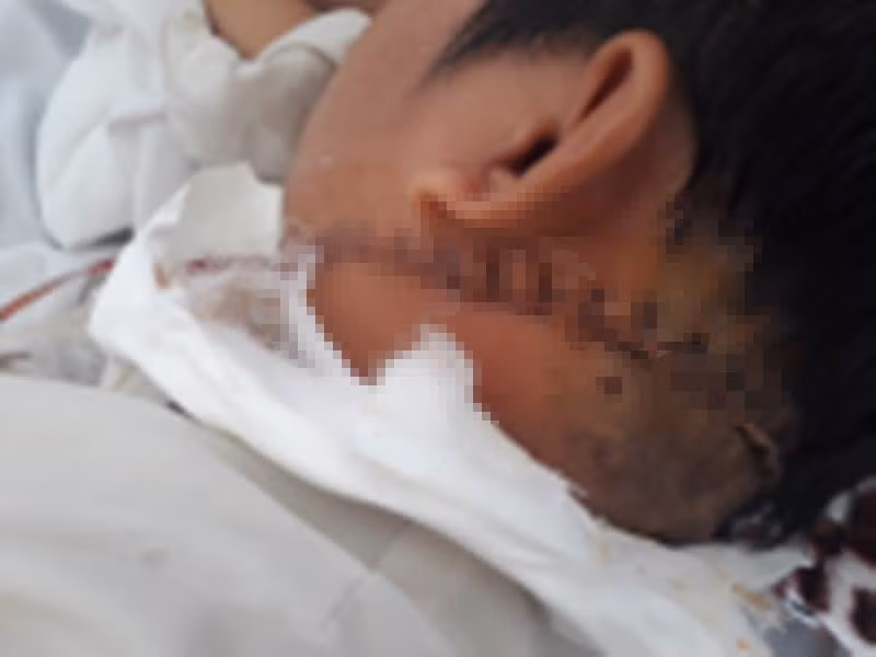 Cứu nam thanh niên bị chém đứt tĩnh mạch cổ Cuu nam thanh nien bi chem dut tinh mach co