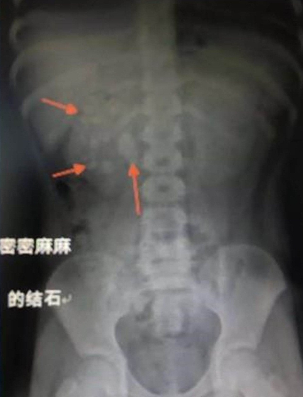 Quyet khong uong nuoc, an rau, cau be gap hoa kinh di...-Hinh-2