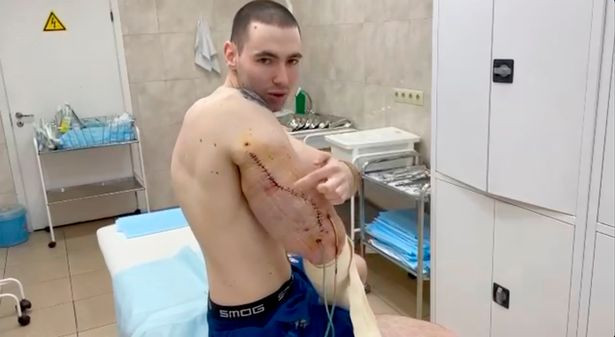 Chang “Popeye” Nga tham my giong “nguoi ngoai hanh tinh”-Hinh-2