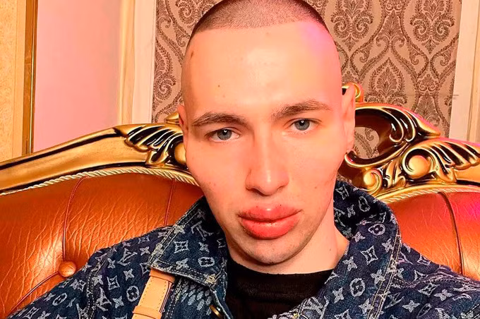 Chang “Popeye” Nga tham my giong “nguoi ngoai hanh tinh”