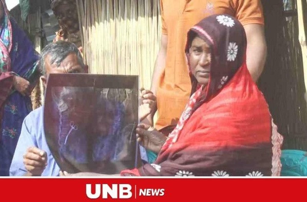 Dau bung suot 20 nam, nguoi phu nu bang hoang khi biet nguyen nhan