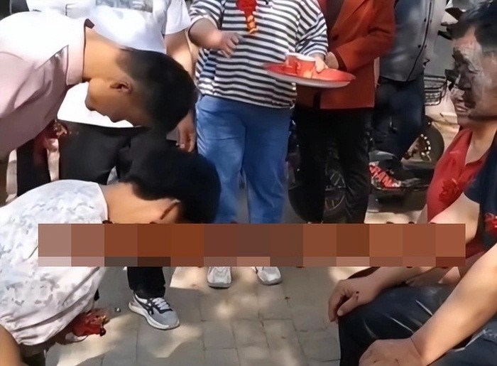 Chu re 20 tuoi lay co dau 35 tuoi bi thieu nang gay tranh cai