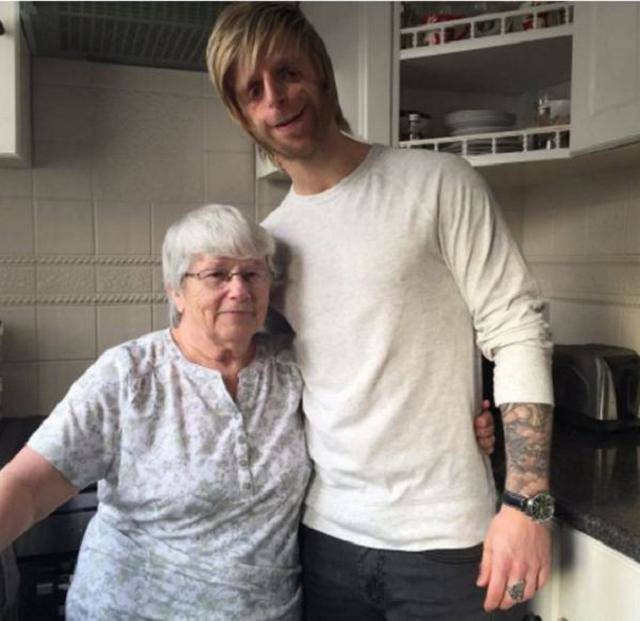 Vì khuôn mặt giống 'quái vật', đứa bé bị chính bố mẹ đẻ bỏ rơi và đem cậu tới trại trẻ mồ côi. May mắn thay là chỉ khoảng 2 tháng sau, bà Jean Lancaster đã quyết định nhận nuôi em bé mồ côi mắc bệnh lạ.