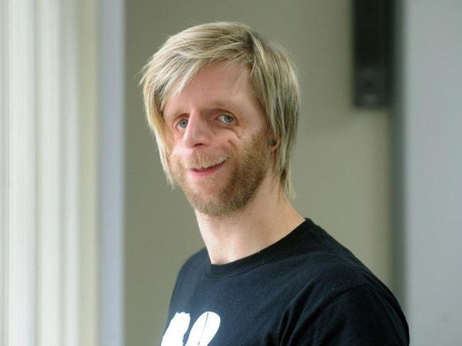 Dù lớn lên trong tình yêu thương vô điều kiện của mẹ, nhưng vì ngoại hình khác biệt, Jono luôn phải đối mặt với sự kì thị, chế giễu của những người xung quanh.