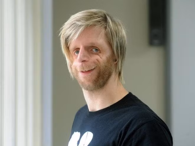 Cuoc song vien man cua chang trai “xau xi” tung bi bo roi-Hinh-5