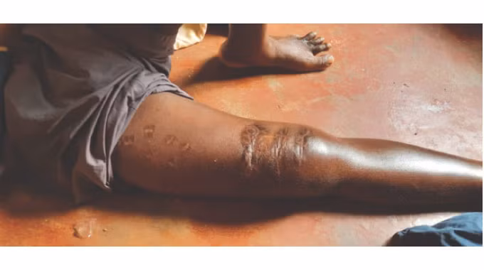 Bi 3 con ca sau “xau xe”, nguoi dan ong song sot than ky-Hinh-3