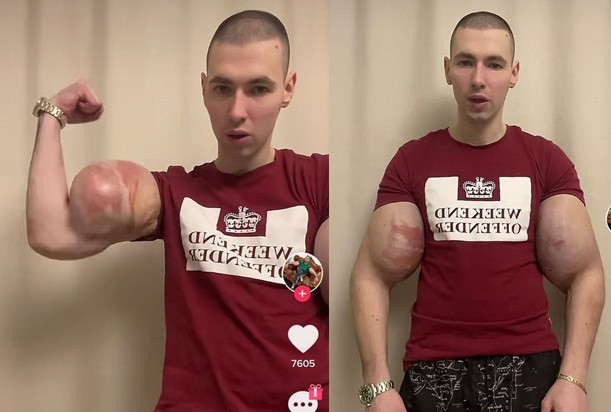 Bi an dang sau co bap “khung” cua chang trai Nga