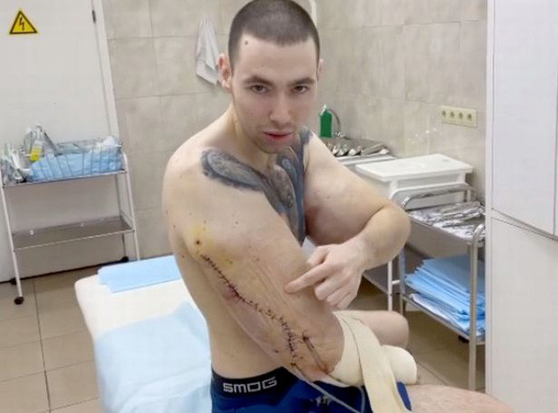 Bi an dang sau co bap “khung” cua chang trai Nga-Hinh-3