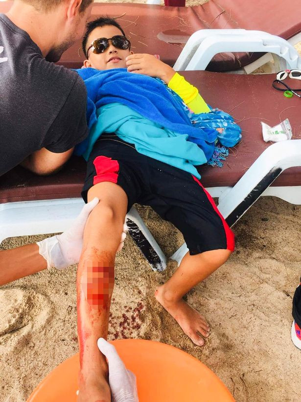 Cau be 8 tuoi song sot nho dung tay dam vao mat ca map-Hinh-2