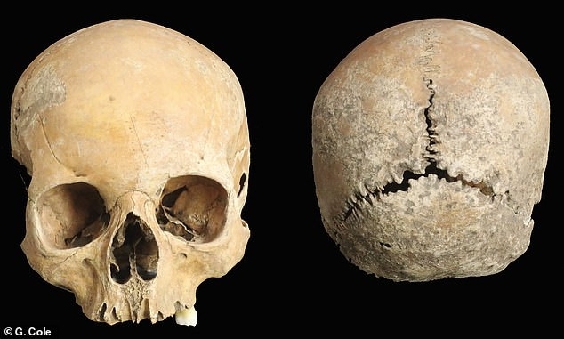 Bí mật sốc hộp sọ thiếu nữ hơn 1.000 tuổi bị cắt mũi, môi Bi mat soc hop so thieu nu hon 1.000 tuoi bi cat mui, moi