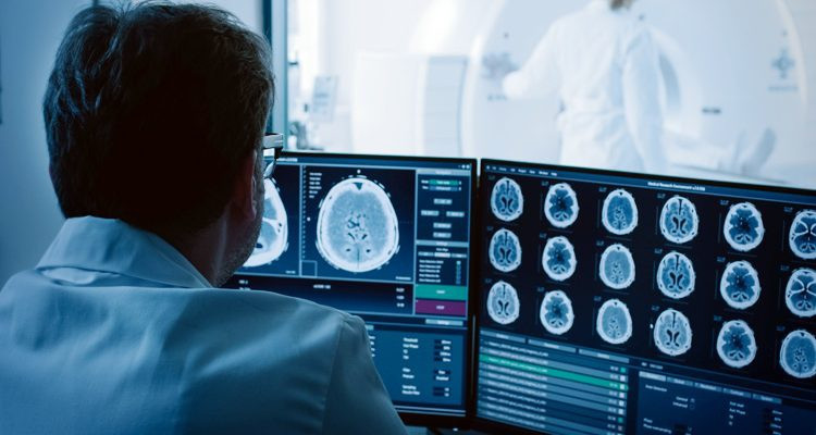 Điều này có nghĩa người bệnh sẽ nói tiếng mẹ đẻ giống như họ là người nước ngoài. Tình trạng hiếm gặp này thường xảy ra đối với những người vừa trải qua một chấn thương sọ não hoặc đột quỵ, ảnh hưởng đến trung tâm ngôn ngữ của bộ não.