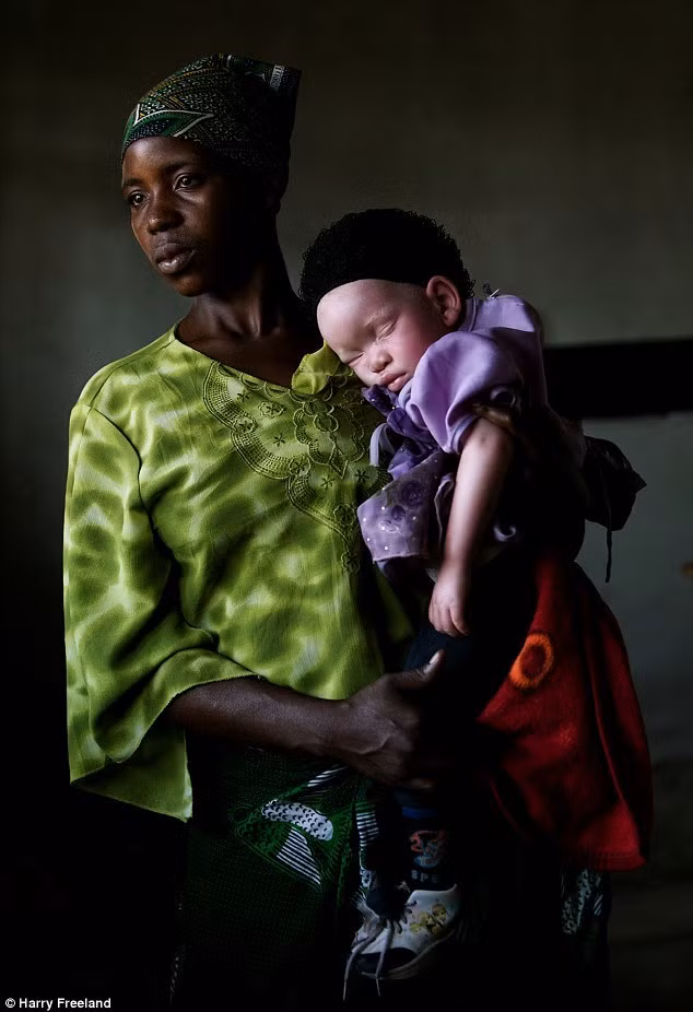 Không ít người dân châu Phi thực sự tin rằng những việc làm của thầy phù thủy, pháp sư thực sự giúp họ thay đổi số mệnh. Do đó, nhiều chuyện khủng khiếp và đau lòng xảy ra.