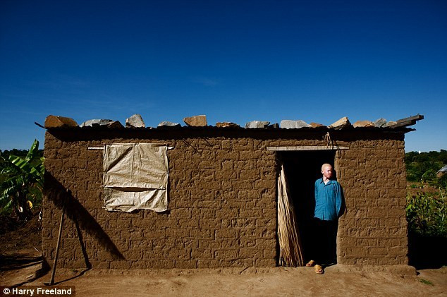 Không những vậy, tà thuật ở châu Phi còn đổ lỗi cho người bạch tạng là nguồn cơn gây ra những dịch bệnh.