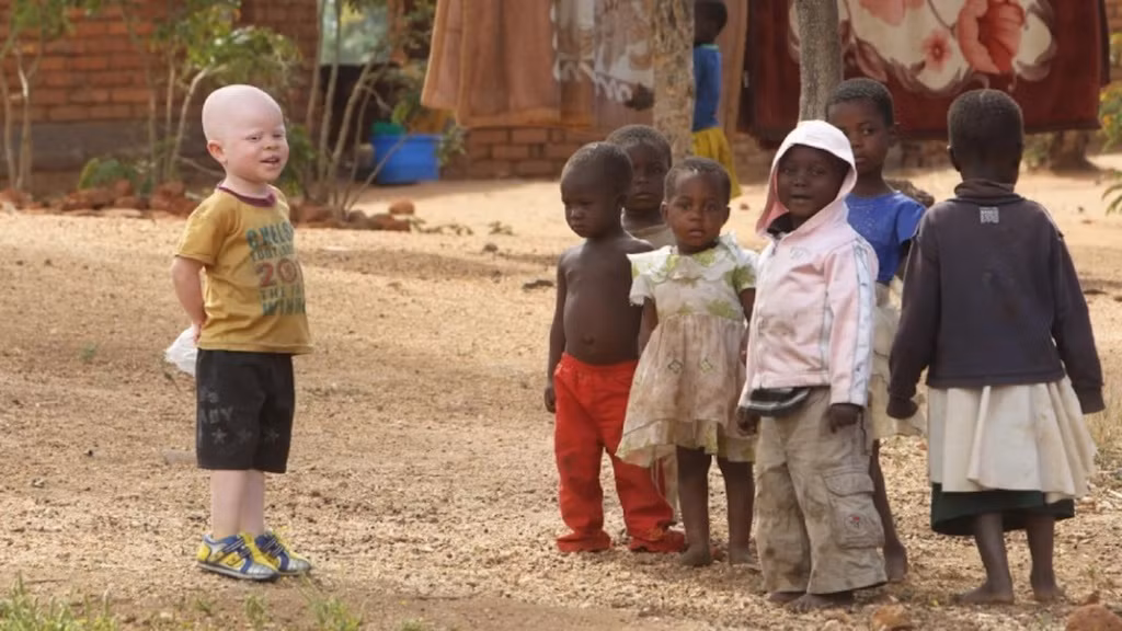 Đây cũng là lý do khiến người bạch tạng thường phải sống trong bất an, lo lắng, thậm chí là sợ hãi. Để bảo vệ nhóm người này, giới chức trách các nước châu Phi và nhiều tổ chức quốc tế thực hiện những chiến dịch nhằm tuyên truyền cho công chúng hiểu đúng về người bạch tạng. Thông qua những chiến dịch hành động này, giới chức trách mong muốn người bạch tạng có cuộc sống tốt hơn.