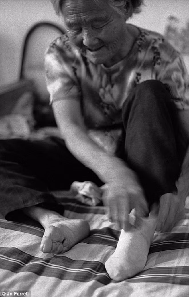 Tập tục "bó chân gót sen" thực hiện ở mọi tầng lớp trong xã hội Trung Quốc trong gần 10 thế kỷ trước khi chấm dứt vào năm 1911. Trong ảnh là bà Gong Xiu Ying, sinh năm 1929 thực hiện bó chân từ năm 15 tuổi.