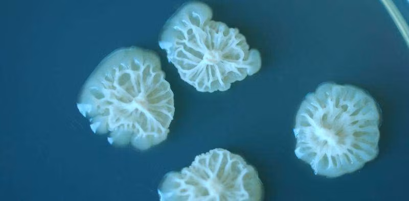 Kham pha soc ve su phat trien cua vi khuan tren khong gian