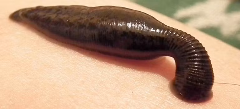 Đỉa có 32 bộ não, chính vì khá tương đồng với hệ thần kinh của con người, nên đỉa được dùng trong nghiên cứu về sự mất ổn định của bộ não. 