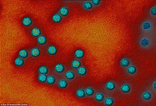  Vi rút bệnh bại liệt. Bại liệt là bệnh do vi rút bại liệt poliovirus gây ra. Bệnh này lây theo đường hô hấp và đường tiêu hoá. Ở dạng nặng nhất của bệnh có thể gây ra tê liệt, khó thở và đôi khi tử vong. Bệnh bại liệt lây truyền từ người sang người chủ yếu là qua đường phân - miệng. Vi rút bại liệt chủ yếu từ phân ô nhiễm vào nguồn nước, thực phẩm rồi vào người qua đường ruột.