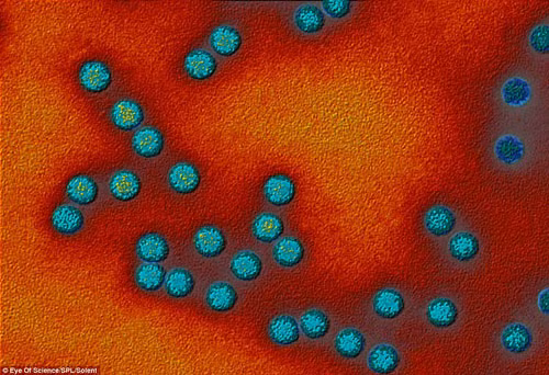  Vi rút bệnh bại liệt. Bại liệt là bệnh do vi rút bại liệt poliovirus gây ra. Bệnh này lây theo đường hô hấp và đường tiêu hoá. Ở dạng nặng nhất của bệnh có thể gây ra tê liệt, khó thở và đôi khi tử vong. Bệnh bại liệt lây truyền từ người sang người chủ yếu là qua đường phân - miệng. Vi rút bại liệt chủ yếu từ phân ô nhiễm vào nguồn nước, thực phẩm rồi vào người qua đường ruột.