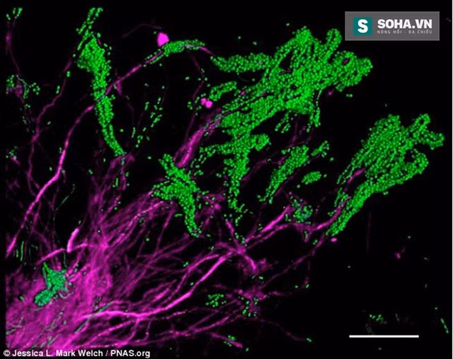  Vi khuẩn bạch hầu. Vi khuẩn bạch hầu là loài vi khuẩn thường được tìm thấy trong miệng của chúng ta, tập trung chủ yếu ở cao răng và mảng bám dưới lợi. Vi khuẩn này cũng được tìm thấy một lượng nhỏ trong nước bọt và phân bố tại bề mặt lưỡi, niêm mạc miêng, vòm miệng, amidan. 