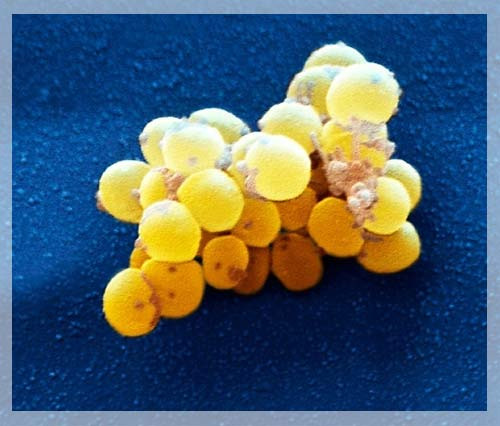 Vi khuẩn Staphlococcus epiderrmis. Vi khuẩn Staphlococcus epiderrmis được xem là một phần không thể tách rời của cơ thể con người, có nhiệm vụ tấn công lại ký sinh trùng Leishmania major, thủ phạm gây bệnh nhiệt đen. Đây là loại vi khuẩn giúp bảo vệ da có lợi tồn tại ngay từ những phút đầu tiên khi chúng ta sinh ra.