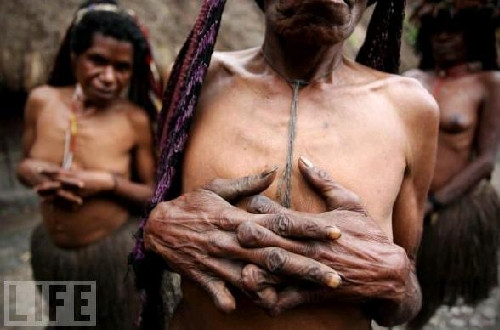 Ngoài truyền thống cắt ngón tay, bộ tộc Dani còn có rất nhiều phong tục độc đáo, thậm chí là ký quái như săn đầu người, cắt bao quy đầu bé trai với hy vọng chúng sẽ sống khỏe hơn.