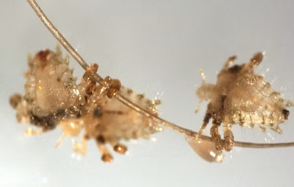  Rận mu còn được gọi là rận cua, chấy cua do có hình dáng giống con cua. Đây là một loài côn trùng hút máu không có cánh, sống ký sinh ở vùng lông mu của con người. Chiều dài của rận mu từ 1,3 - 2mm và có khả năng thay đổi màu sắc giống màu da người.