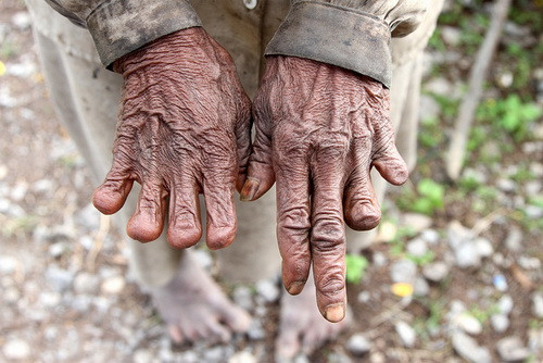 Hiện nay, nghi thức cắt ngón tay của bộ tộc này đã bị chính phủ Indonesia cấm.