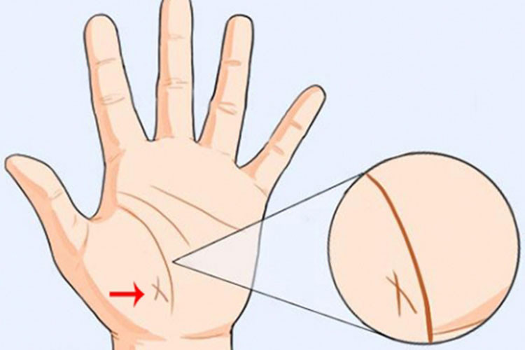 Cũng giống như đường vân tay 3 vạch cắt dọc ở trên, người nào có đường vân tay gạch chéo nhau như hình chữ X này cũng luôn gặp may mắn và có quý nhân phù trợ. Người này sau này càng về già càng đạt được nhiều của cải và có cuộc sống hôn nhân viên mãn.