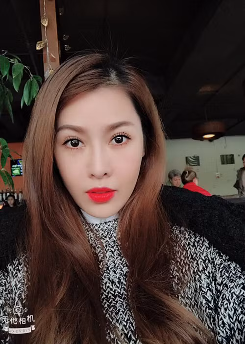 Cận nhan sắc của Quế Vân hậu phẫu thuật thẩm mỹ.