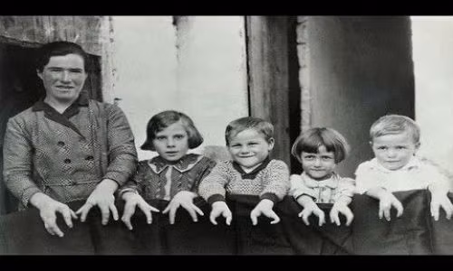 Xot xa voi nhung di tat ky di, hiem gap tren the gioi